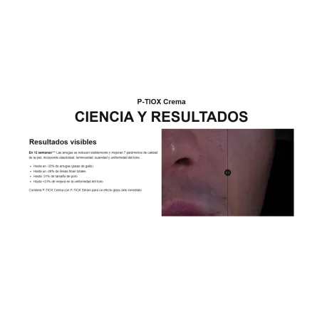 resultados Ptiox crema