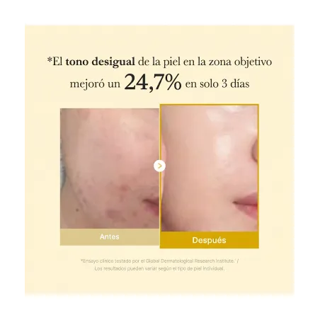 antes y después de Medicube Kojic Acid Turmeric Night Wrapping Mask
